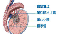 [安庆医院看男科哪家好]安庆男性患有附睾炎有什么影响？