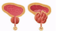 男性出现前列腺痛该怎么治？安庆专治前列腺痛的医院？